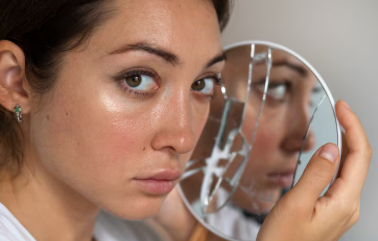 How to Repair a Damaged Skin Barrier (Step-by-Step Guide) Imagen