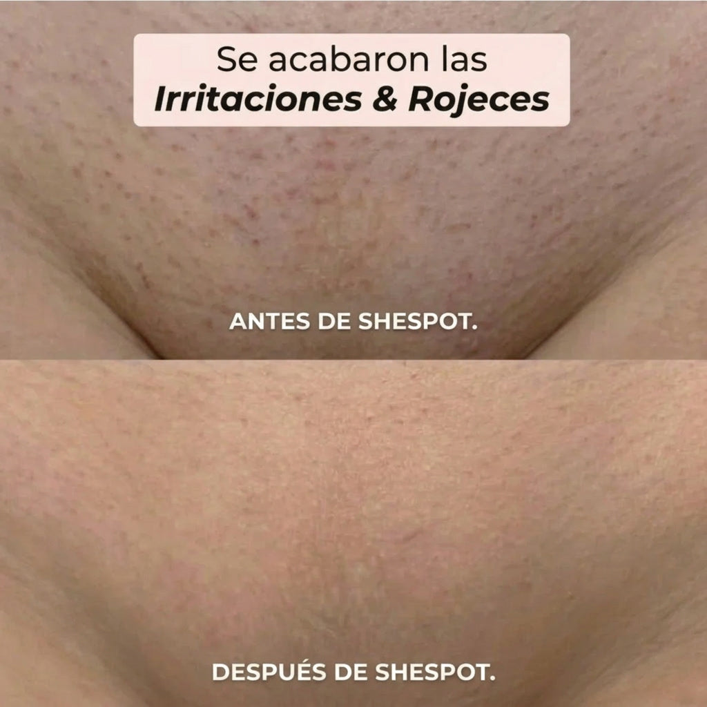 Maquinilla 2 en 1 para Bikini y Cuerpo -Shespot®